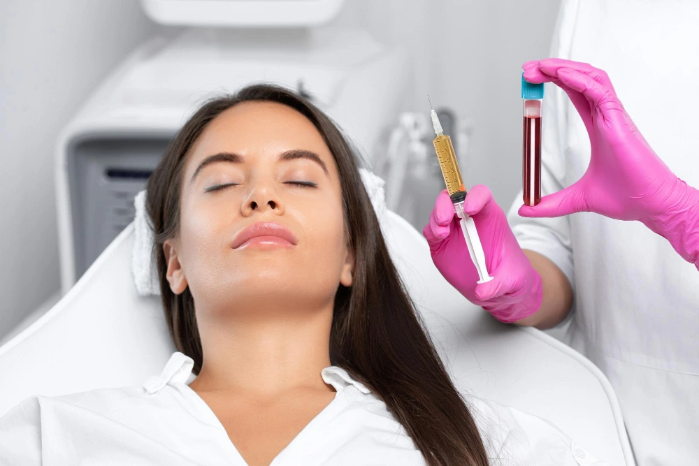 PRF treatment preparation with blood sample and syringe for facial rejuvenation in Kirkland, WA